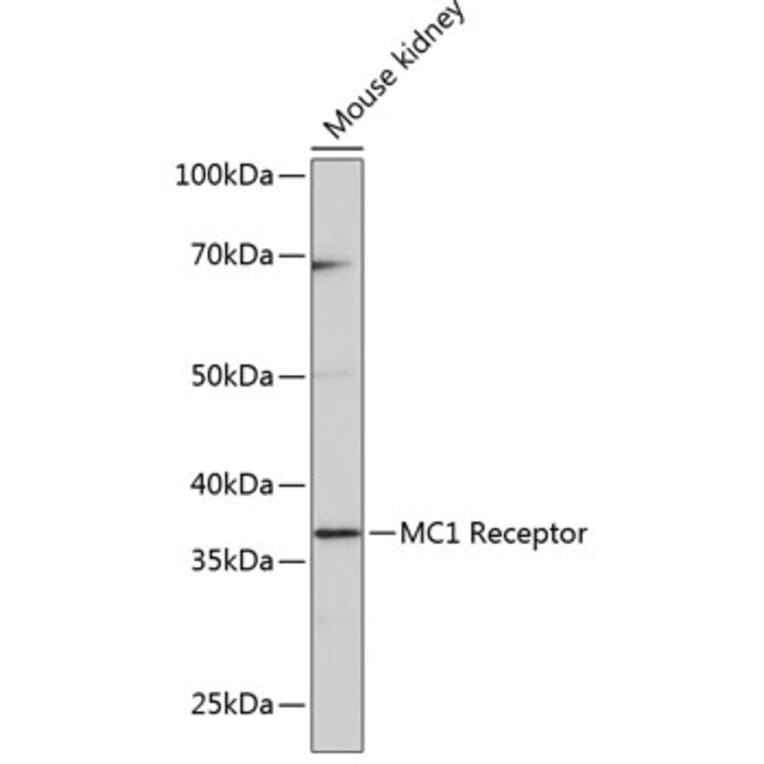 Western Blot - Anti-MC1-R Antibody [ARC0638] (A80622) - Antibodies.com