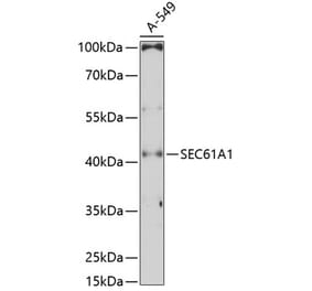 Western Blot - Anti-SEC61A Antibody (A80623) - Antibodies.com