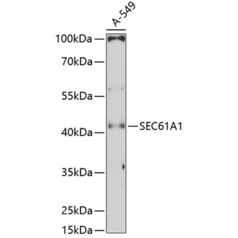 Western Blot - Anti-SEC61A Antibody (A80623) - Antibodies.com