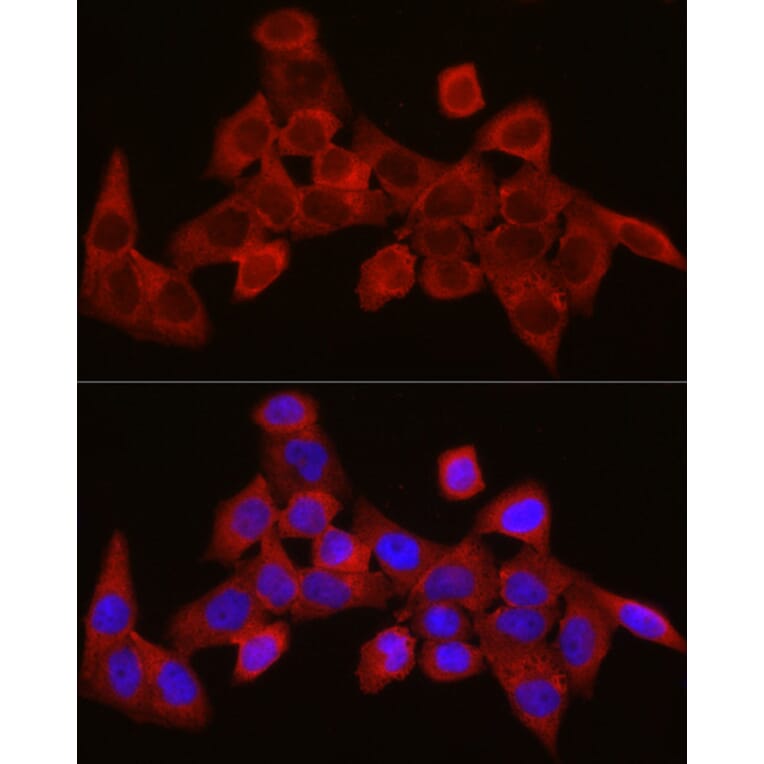 Immunofluorescence - Anti-SEC61A Antibody (A80623) - Antibodies.com