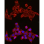 Immunofluorescence - Anti-SEC61A Antibody (A80623) - Antibodies.com