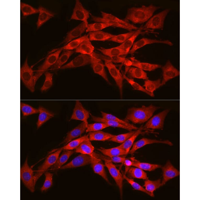 Immunofluorescence - Anti-SEC61A Antibody (A80623) - Antibodies.com