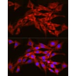 Immunofluorescence - Anti-SEC61A Antibody (A80623) - Antibodies.com