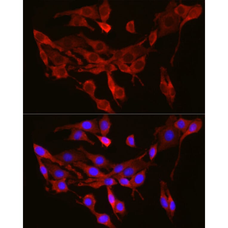 Immunofluorescence - Anti-SEC61A Antibody (A80623) - Antibodies.com