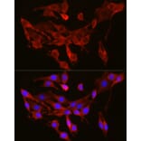 Immunofluorescence - Anti-SEC61A Antibody (A80623) - Antibodies.com