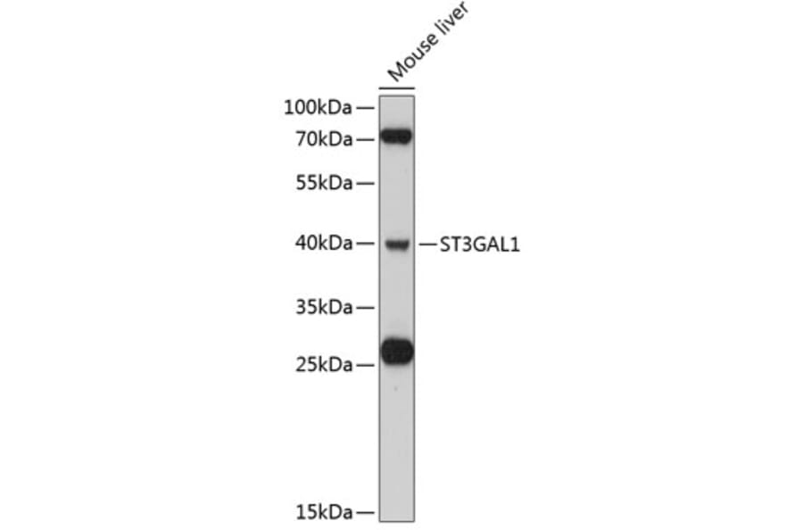Western Blot - Anti-ST3Gal I Antibody (A80624) - Antibodies.com
