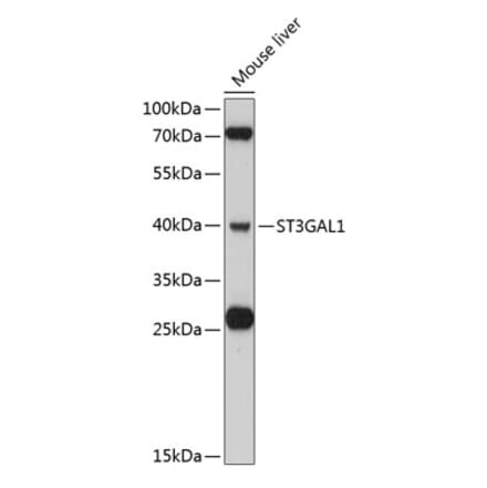 Western Blot - Anti-ST3Gal I Antibody (A80624) - Antibodies.com