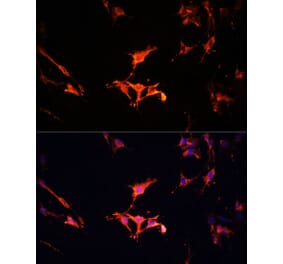Immunofluorescence - Anti-LAMTOR1 Antibody (A80625) - Antibodies.com