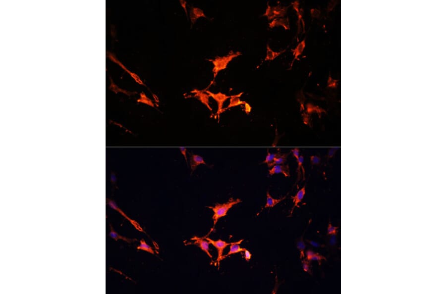 Immunofluorescence - Anti-LAMTOR1 Antibody (A80625) - Antibodies.com