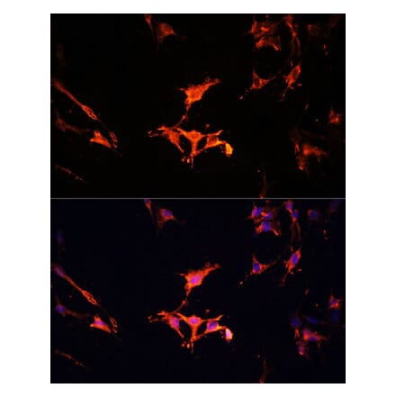 Immunofluorescence - Anti-LAMTOR1 Antibody (A80625) - Antibodies.com