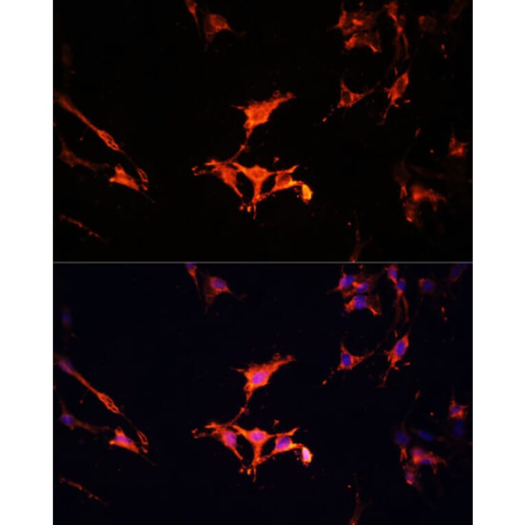 Immunofluorescence - Anti-LAMTOR1 Antibody (A80625) - Antibodies.com