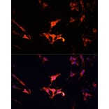 Immunofluorescence - Anti-LAMTOR1 Antibody (A80625) - Antibodies.com