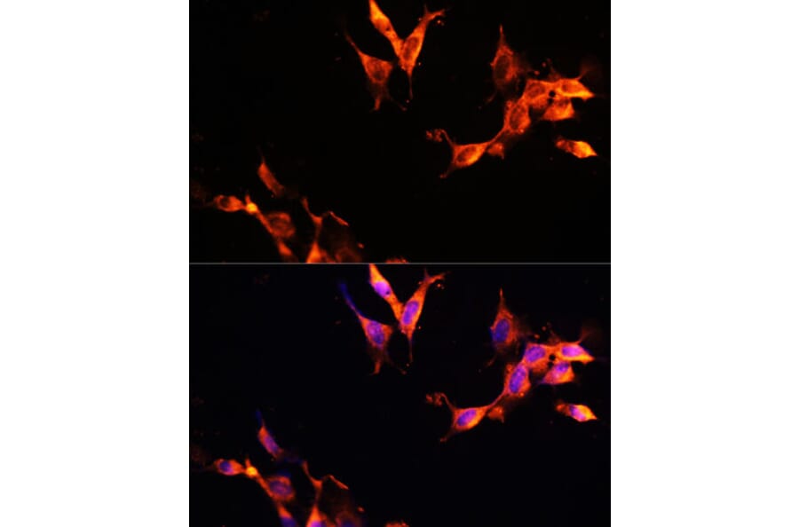 Immunofluorescence - Anti-LAMTOR1 Antibody (A80625) - Antibodies.com