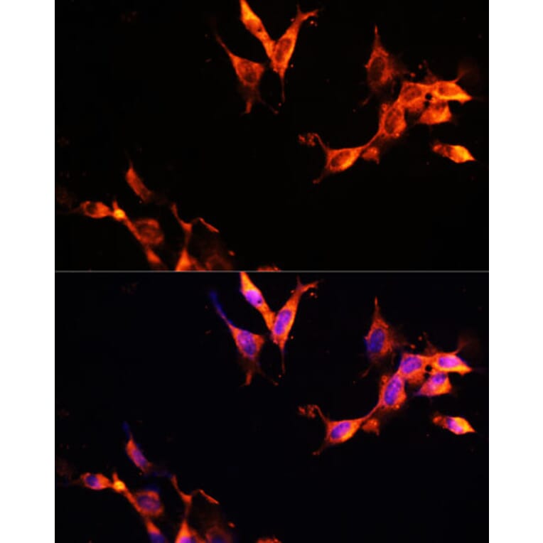 Immunofluorescence - Anti-LAMTOR1 Antibody (A80625) - Antibodies.com