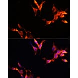 Immunofluorescence - Anti-LAMTOR1 Antibody (A80625) - Antibodies.com