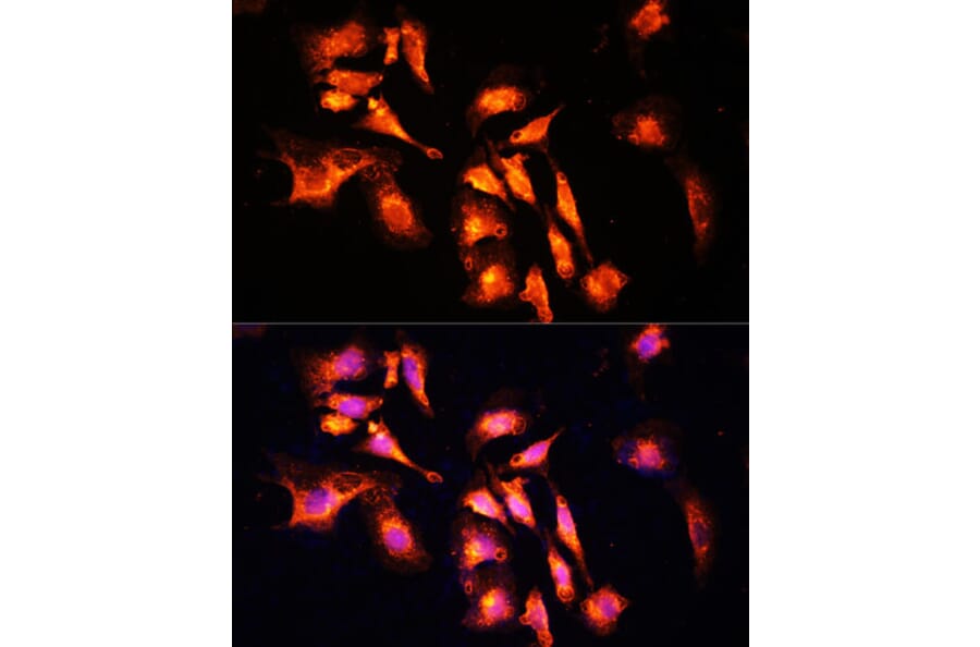 Immunofluorescence - Anti-LAMTOR1 Antibody (A80625) - Antibodies.com