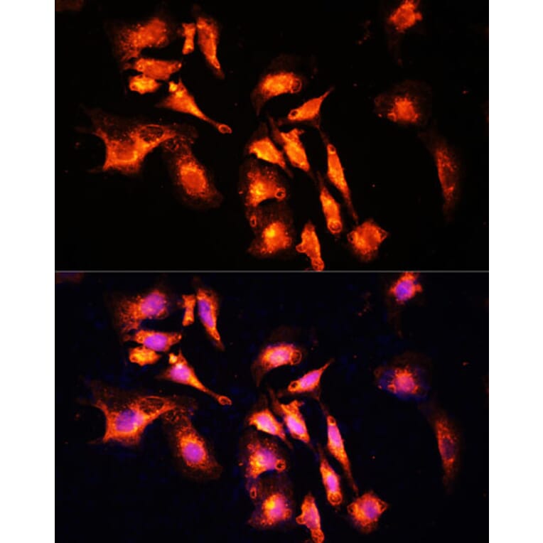 Immunofluorescence - Anti-LAMTOR1 Antibody (A80625) - Antibodies.com