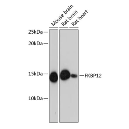 Western Blot - Anti-FKBP12 Antibody [ARC0654] (A80626) - Antibodies.com