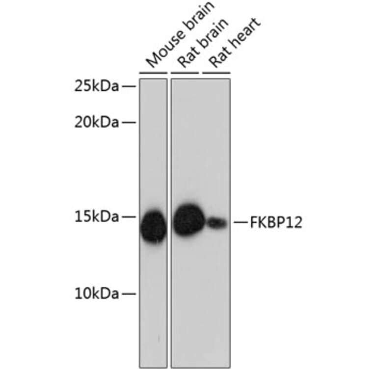 Western Blot - Anti-FKBP12 Antibody [ARC0654] (A80626) - Antibodies.com