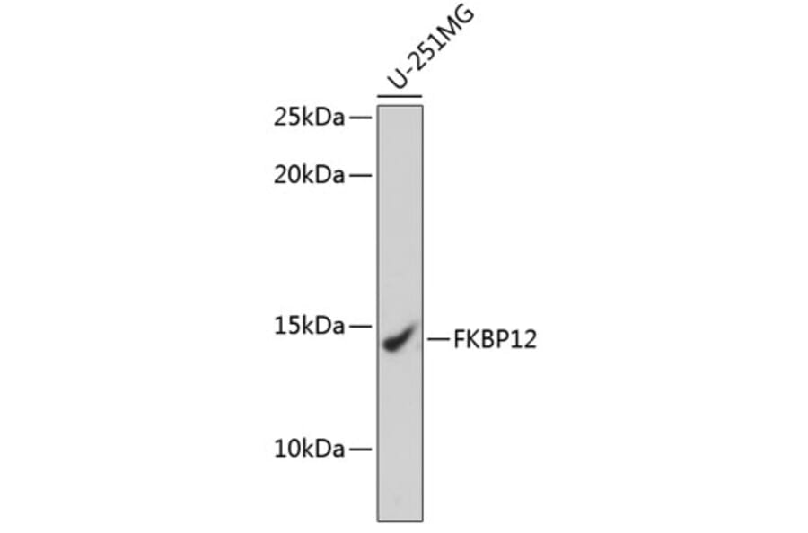 Western Blot - Anti-FKBP12 Antibody [ARC0654] (A80626) - Antibodies.com