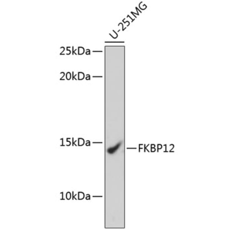 Western Blot - Anti-FKBP12 Antibody [ARC0654] (A80626) - Antibodies.com