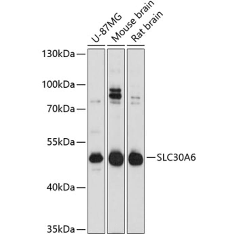 Western Blot - Anti-ZnT6 Antibody (A80627) - Antibodies.com