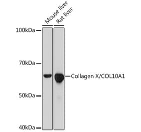 Western Blot - Anti-Collagen X Antibody [ARC0659] (A80628) - Antibodies.com