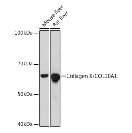 Western Blot - Anti-Collagen X Antibody [ARC0659] (A80628) - Antibodies.com