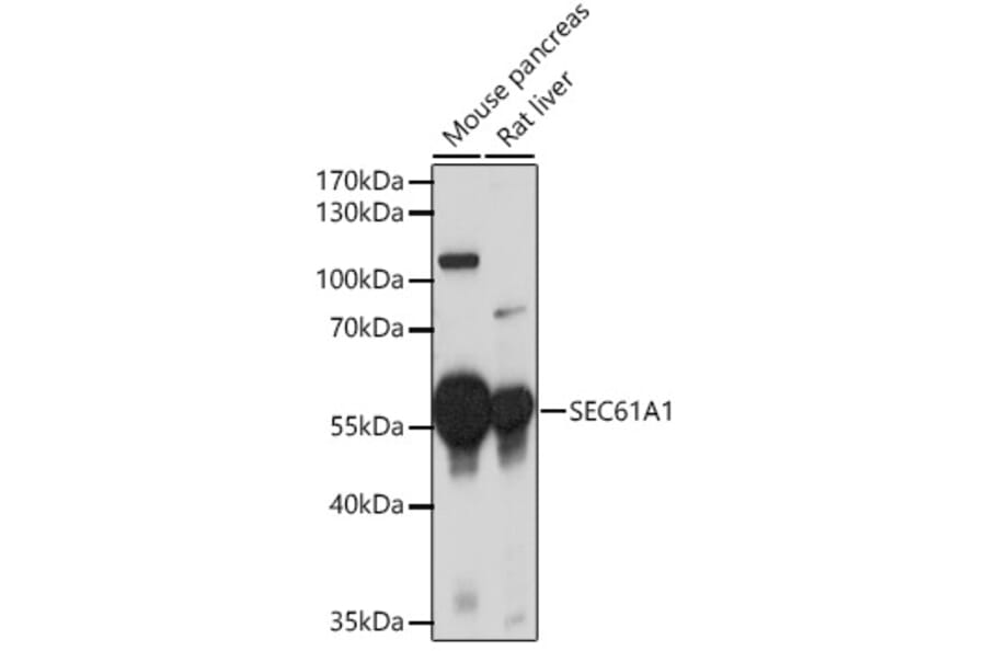 Western Blot - Anti-SEC61A Antibody (A80629) - Antibodies.com