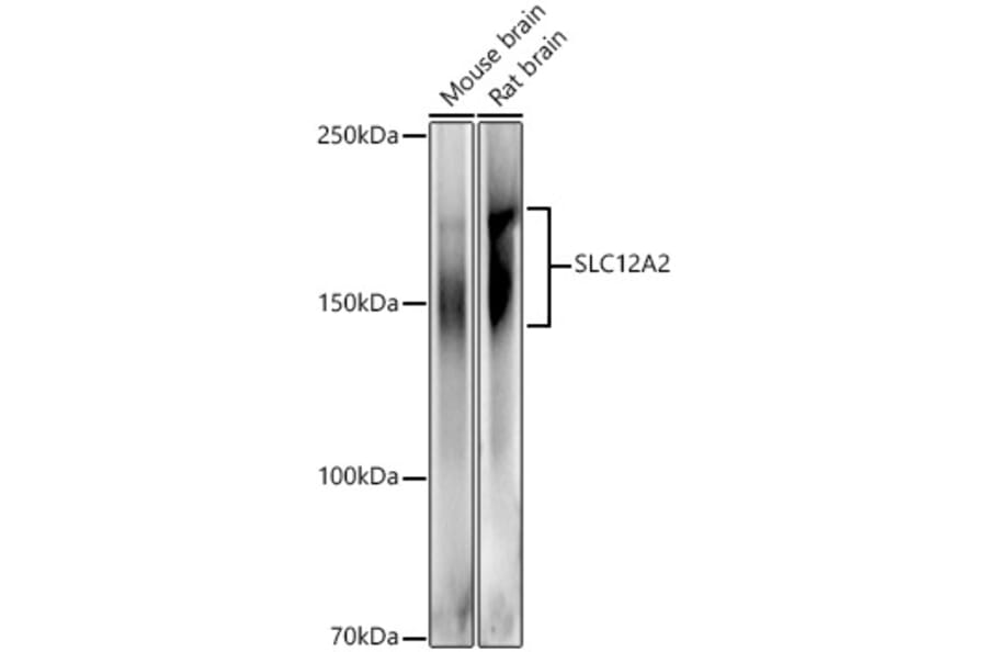 Western Blot - Anti-NKCC1 Antibody (A80631) - Antibodies.com