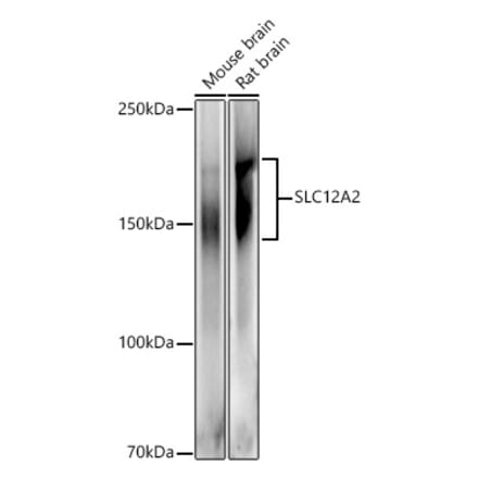 Western Blot - Anti-NKCC1 Antibody (A80631) - Antibodies.com