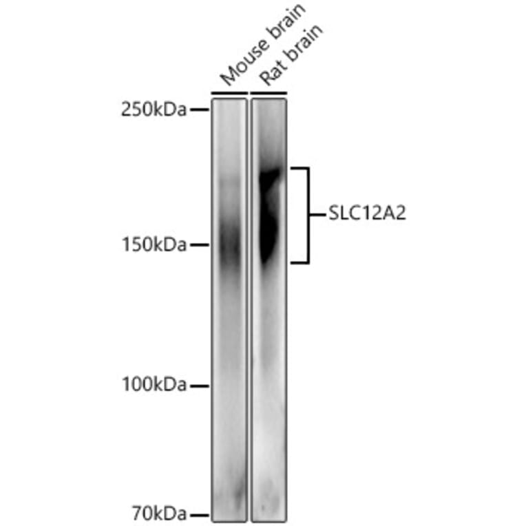 Western Blot - Anti-NKCC1 Antibody (A80631) - Antibodies.com