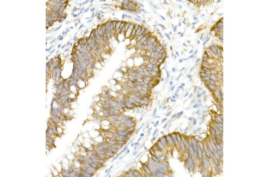 Immunohistochemistry - Anti-NKCC1 Antibody (A80631) - Antibodies.com