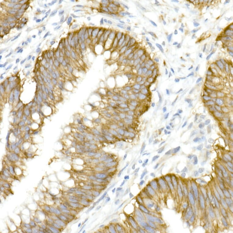 Immunohistochemistry - Anti-NKCC1 Antibody (A80631) - Antibodies.com