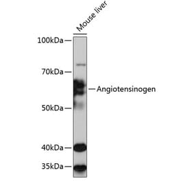 Western Blot - Anti-Angiotensinogen Antibody [ARC0677] (A80632) - Antibodies.com