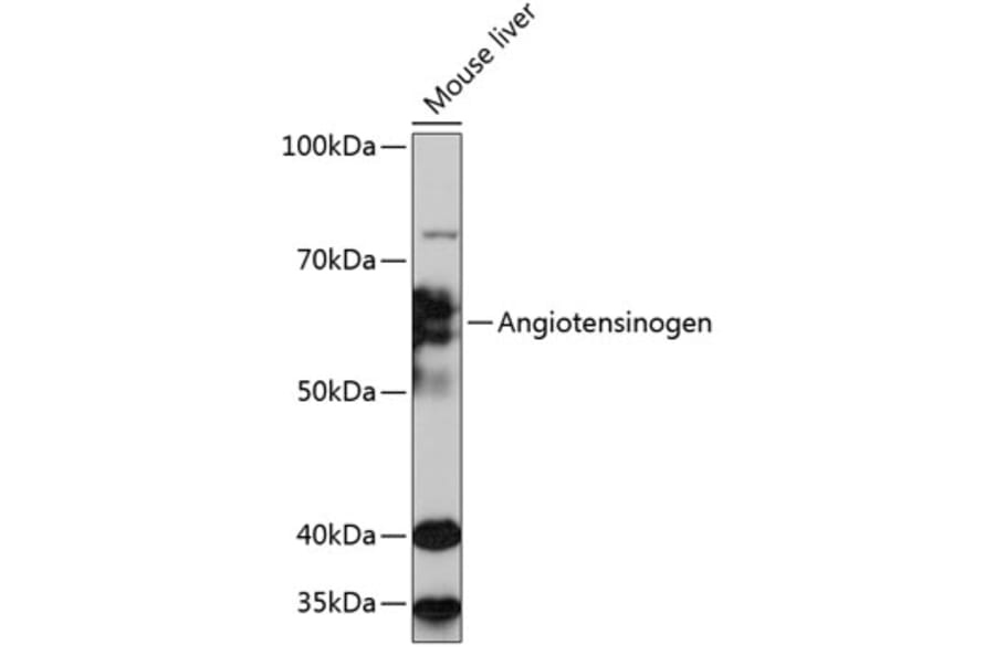 Western Blot - Anti-Angiotensinogen Antibody [ARC0677] (A80632) - Antibodies.com