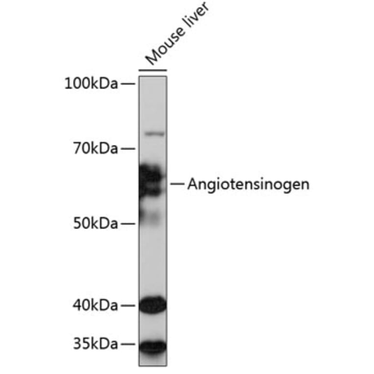 Western Blot - Anti-Angiotensinogen Antibody [ARC0677] (A80632) - Antibodies.com