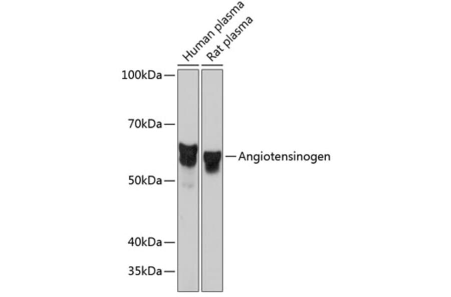 Western Blot - Anti-Angiotensinogen Antibody [ARC0677] (A80632) - Antibodies.com