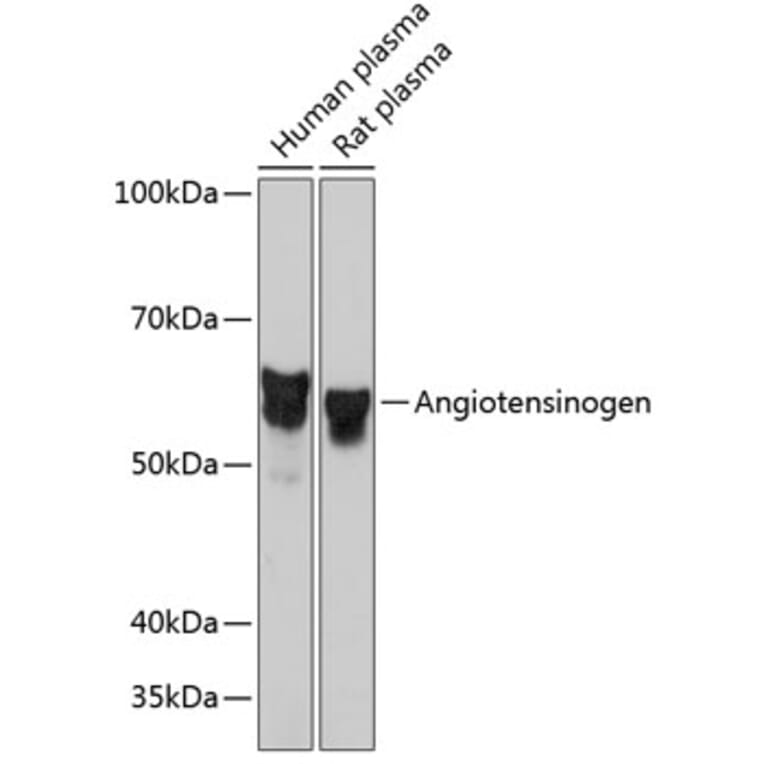 Western Blot - Anti-Angiotensinogen Antibody [ARC0677] (A80632) - Antibodies.com