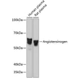 Western Blot - Anti-Angiotensinogen Antibody [ARC0677] (A80632) - Antibodies.com