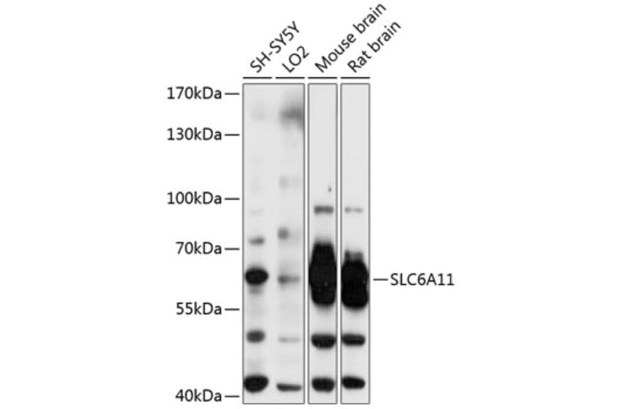 Western Blot - Anti-GABA Transporter 3 / GAT 3 Antibody (A80633) - Antibodies.com