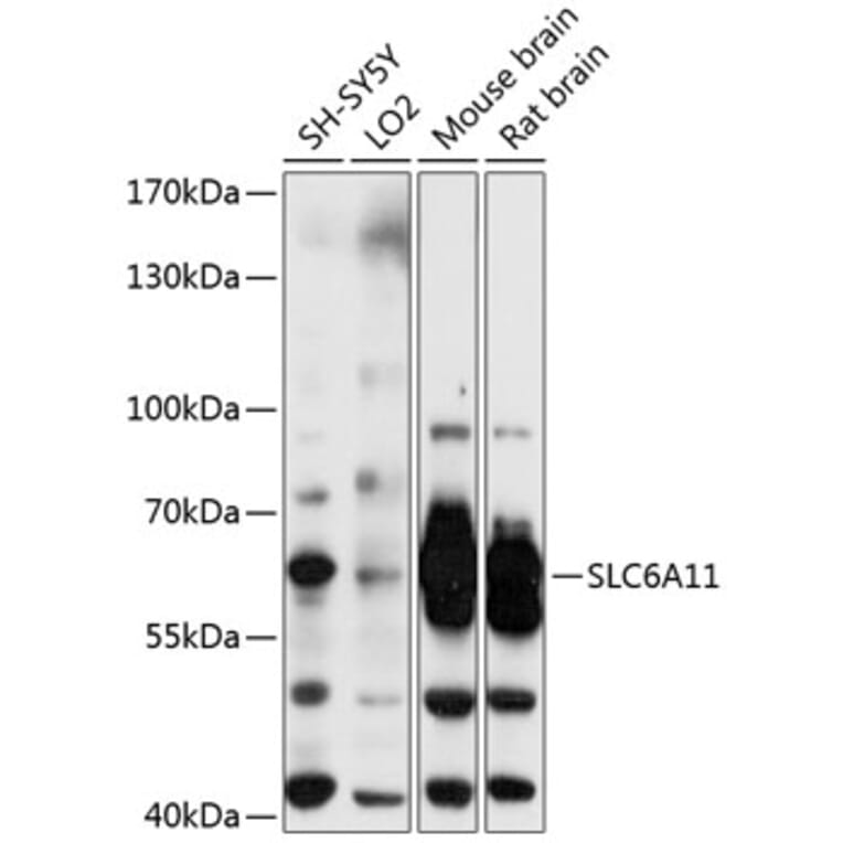Western Blot - Anti-GABA Transporter 3 / GAT 3 Antibody (A80633) - Antibodies.com