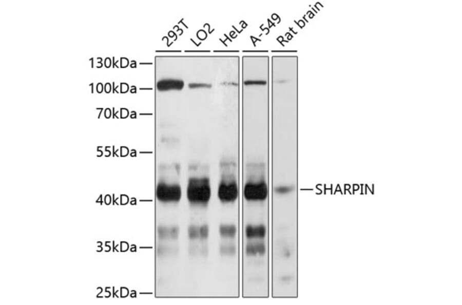 Western Blot - Anti-SHARPIN Antibody (A80634) - Antibodies.com