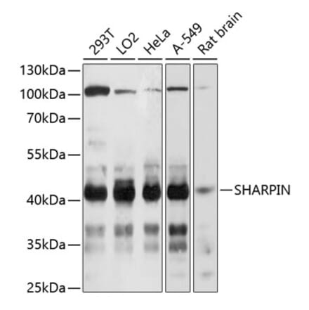 Western Blot - Anti-SHARPIN Antibody (A80634) - Antibodies.com