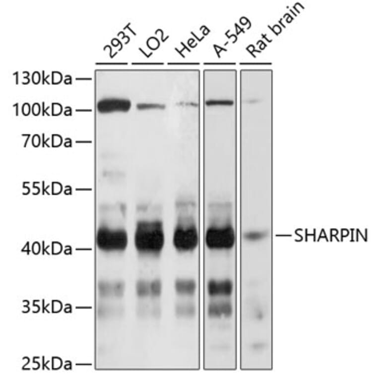 Western Blot - Anti-SHARPIN Antibody (A80634) - Antibodies.com