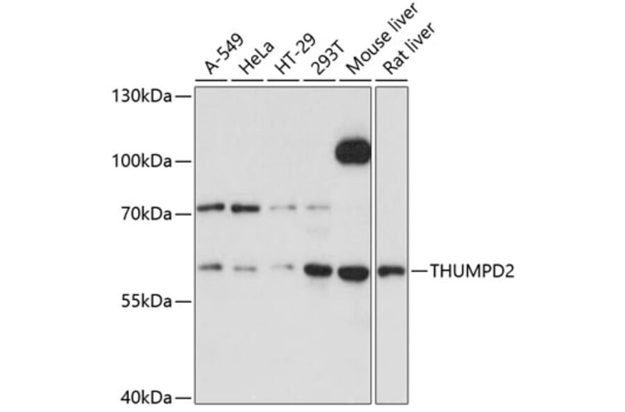 Western Blot - Anti-THUMPD2 Antibody (A80635) - Antibodies.com