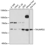 Western Blot - Anti-THUMPD2 Antibody (A80635) - Antibodies.com