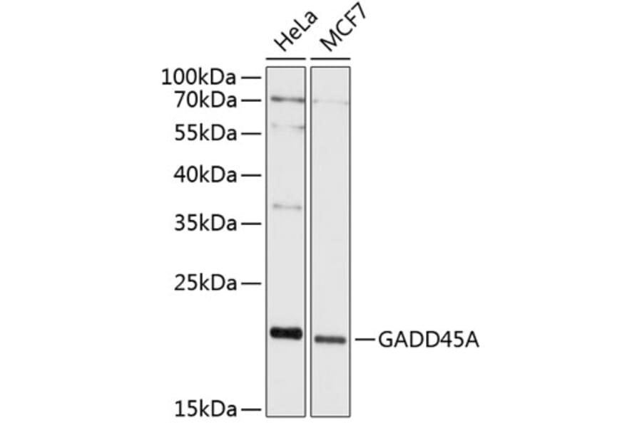Western Blot - Anti-GADD45A Antibody (A80636) - Antibodies.com