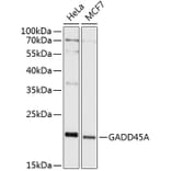 Western Blot - Anti-GADD45A Antibody (A80636) - Antibodies.com
