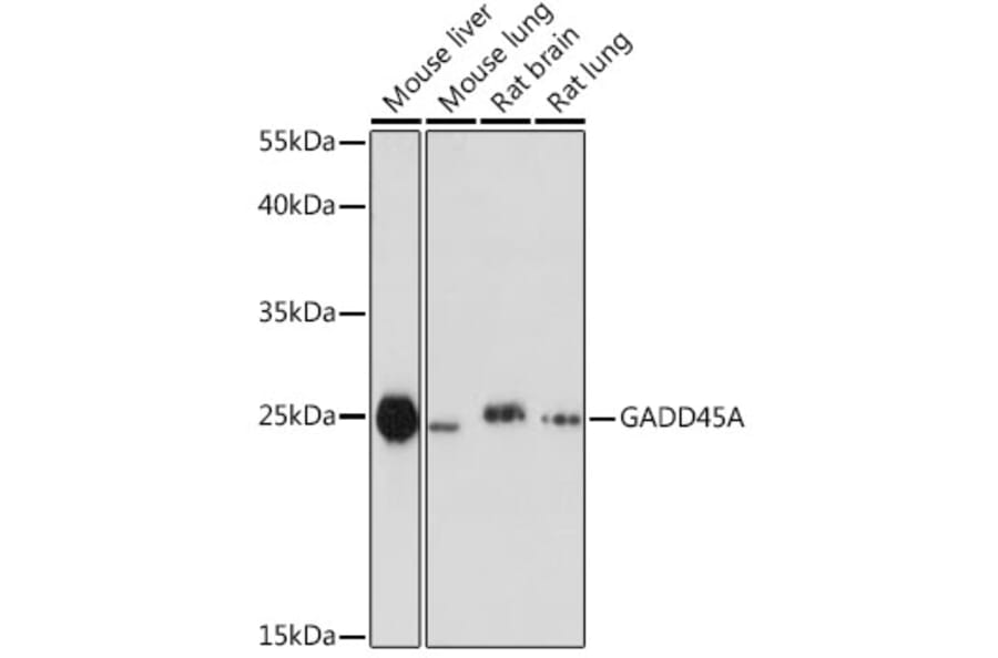 Western Blot - Anti-GADD45A Antibody (A80636) - Antibodies.com